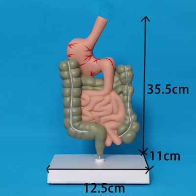 Патологическая модель толстой кишки желудочно-кишечного тракта Corpo GIT-4