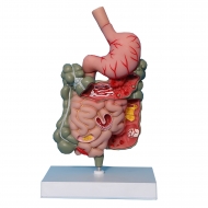 Патологическая модель толстой кишки желудочно-кишечного тракта Corpo GIT